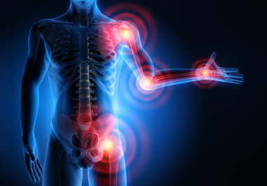 Medical illustration of a human skeleton with glowing red joints highlighting shoulder, elbow, wrist, hip, and knee areas indicating pain or inflammation in multiple joints.