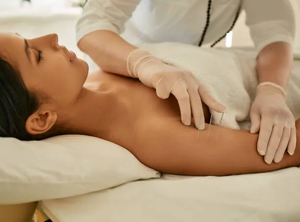 Woman lying on her side while a clinician inserts fine acupuncture needles into her upper arm; gloves on hands.