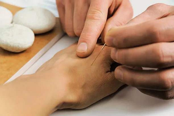 Close-up of a practitioner inserting a thin acupuncture needle into a patient's hand.