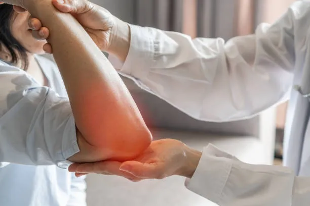 Medical professional holds a patient’s red, inflamed elbow during examination.
