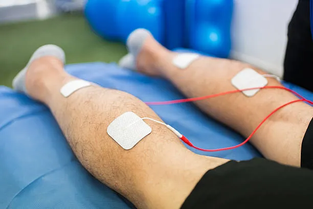 Legs undergoing electrotherapy with several rectangular white adhesive pads and red wires on a blue therapy table, indicating a physical therapy session for leg treatment.